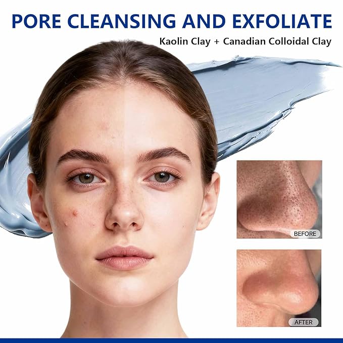 Deep Pore Cleansing Blue Clay Mask for Face, Kaolin Clay Masks for Blackheads and Pores with Niacinamide for Even Out, Hydrating Mud Mask with Brush for All Skin Types（5.3 oz）