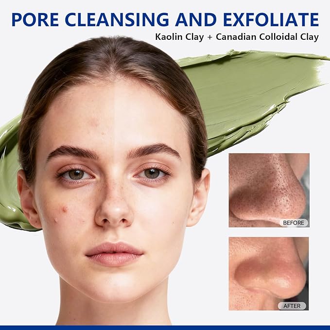 Deep Cleansing Green Clay Mask for Face, Kaolin Clay Masks Blackheads and Pores with Mung Bean for Soothing Oil Control, Mud Mask with Brush for All Skin Types（5.3 oz）