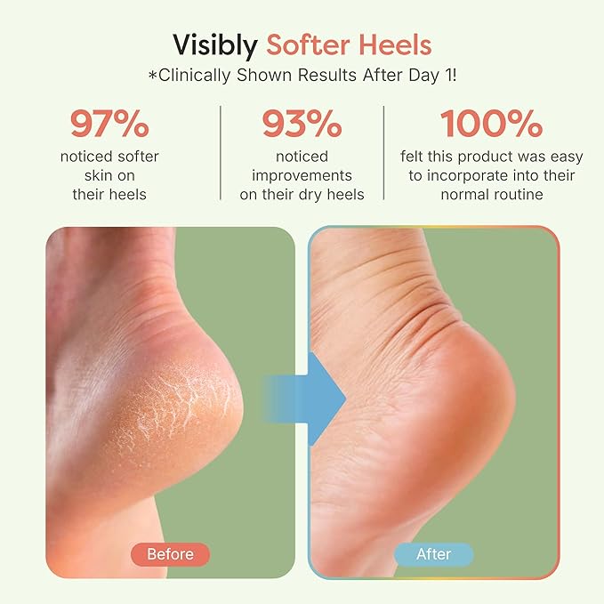 ZenToes Moisturizing Socks for Cracked Heel Treatment, Vitamin E, Olive Oil and Jojoba Oil Heel Socks, Stocking Stuffers for Women, Spa Self Care Gifts for Women (Fuzzy Mint Green, Regular)
