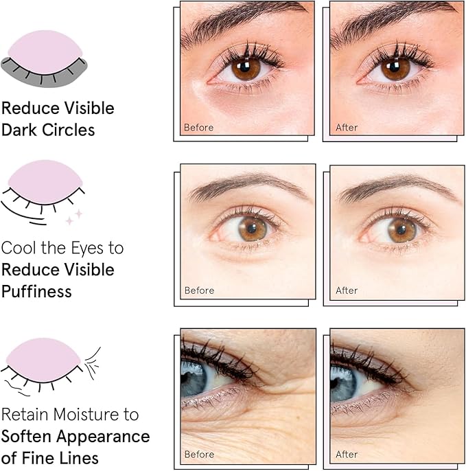 grace & stella Award Winning Under Eye Mask Reduce Dark Circles, Puffy Eyes, Wrinkles - Undereye Patches -White Elephant Gifts for Adults (Blue Eye Mask 48 Pairs + Hyaluronic Acid Serum 17ml)