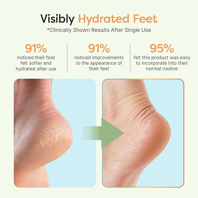 ZenToes Moisturizing Socks for Cracked Heel Treatment, Vitamin E, Olive Oil and Jojoba Oil Heel Socks, Stocking Stuffers for Women, Spa Self Care Gifts for Women (Yellow & White Daisies, Regular)