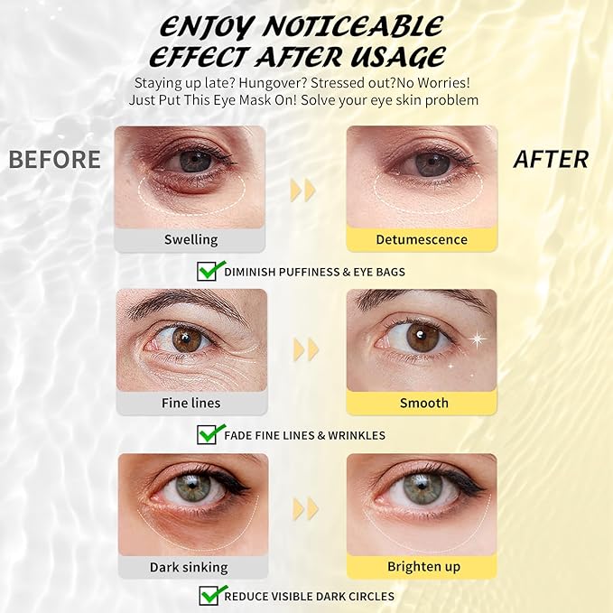 Under Eye Patches (25 Pairs), Caffeine Eye Masks for Dark Circles Puffy Eyes Undereye Bags, Collagen Eye Patches for Wrinkles and Puffiness, Skin Care Gift for Her