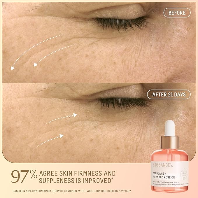 Biossance Bright Luminaries Set – Vitamin C Rose Oil & Lip Perfector Travel Duo for Brighter, Hydrated Skin and Lips | Limited-Edition Gift Set ($47 Value)